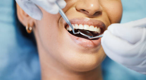 Best Emergency Dental Care for Broken or Chipped Teeth in Garner, IA